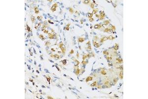 Immunohistochemistry of paraffin-embedded human stomach using RN antibody (ABIN3015630, ABIN3015631, ABIN3015632 and ABIN6218985) at dilution of 1:100 (40x lens). (RNASE3 antibody  (AA 28-160))