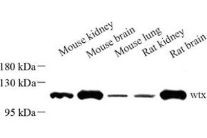 Western blot analysis of wtx (ABIN7073078) at dilution of 1: 500 (WTX antibody)