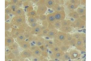 Detection of C2 in Human Liver Tissue using Polyclonal Antibody to Complement Component 2 (C2) (Complement C2 antibody  (AA 245-451))