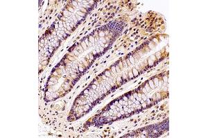 Immunohistochemistry analysis of paraffin embedded human colon using MTHFD1 (ABIN7074609) at dilution of 1: 700