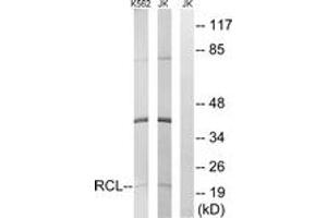 Western blot analysis of extracts from Jurkat/K562 cells, using RCL Antibody.