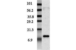 Western blot analysis of adipocyte-conditioned medium from human male and female with different expression levels using anti-Resistin (human), pAb (Biotin) . (Resistin antibody  (Biotin))