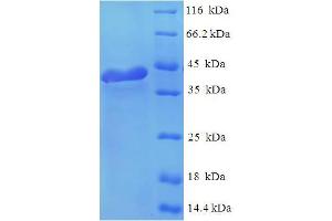 SDS-PAGE (SDS) image for Regulator of G-Protein Signaling 2 (RGS2) (AA 1-211), (full length) protein (His-SUMO Tag) (ABIN4975677) (RGS2 Protein (AA 1-211, full length) (His-SUMO Tag))
