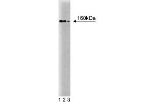 Western blot analysis of ROCK-I on mouse kidney lysate. (ROCK1 antibody  (AA 906-1012))