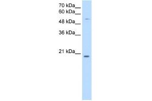 WB Suggested Anti-CHIC2 Antibody Titration:  0. (CHIC2 antibody  (N-Term))