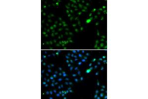 Immunofluorescence analysis of HeLa cells using FKBP3 antibody (ABIN5974155). (FKBP3 antibody)