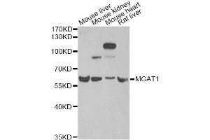 Western blot analysis of extracts of various cell lines, using MGAT1 antibody (ABIN2563858) at 1:1000 dilution. (MGAT1 antibody)