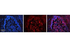 Immunohistochemistry (IHC) image for anti-Forkhead Box O3 (FOXO3) (N-Term) antibody (ABIN2780366)