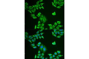 Immunofluorescence analysis of U2OS cells using MLANA antibody (ABIN5973714). (MLANA antibody)