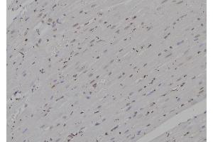 ABIN6277235 at 1/100 staining Rat heart tissue by IHC-P.