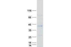 Mitochondrial Fission Regulator 1-Like (MTFR1L) (Transcript Variant 1) protein (Myc-DYKDDDDK Tag)