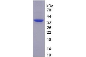 SDS-PAGE analysis of recombinant Human TNIP2 Protein.