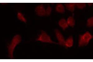 ABIN6275621 staining Hela by IF/ICC. (CD6 antibody  (Internal Region))
