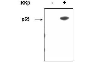 Western blot using  affinity purified anti-p65 (RelA) pS536 antibody shows detection of p65 phosphorylated at S536.