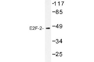 Image no. 1 for anti-E2F Transcription Factor 2 (E2F2) antibody (ABIN272230)