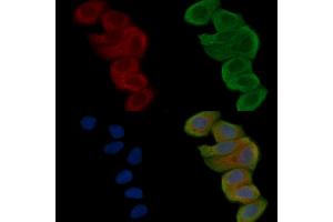 ABIN6262048 and ABIN6268844 staining Hela cells(30 min of UV treatment) by IF/ICC.