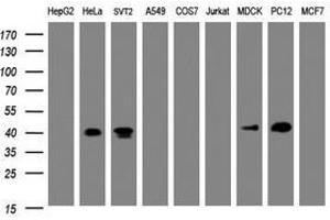 Image no. 1 for anti-NudE Nuclear Distribution E Homolog (A. Nidulans)-Like 1 (NDEL1) antibody (ABIN1499857) (NDEL1 antibody)
