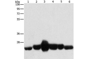 Western Blot analysis of Human fetal muscle and fetal lung tissue, Human leiomyosarcoma tissue, Mouse lung and heart tissue, NIH/3T3 cell using CAV1 Polyclonal Antibody at dilution of 1:550 (Caveolin-1 antibody)