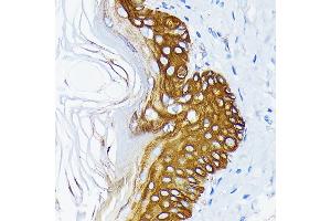 Immunohistochemistry of paraffin-embedded rat skin using Cytokeratin 14 (KRT14) (KRT14) Rabbit mAb (ABIN7268091) at dilution of 1:100 (40x lens). (KRT14 antibody)