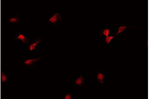 ABIN6269103 staining MCF-7 cells by IF/ICC.
