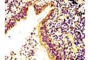 Immunohistochemistry (IHC) image for anti-Ribosomal Protein S6 Kinase, 90kDa, Polypeptide 6 (RPS6KA6) (AA 340-467) antibody (ABIN7168192)