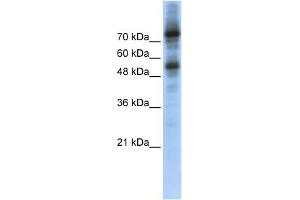 WB Suggested Anti-FOXM1 Antibody Titration:  0. (FOXM1 antibody  (Middle Region))