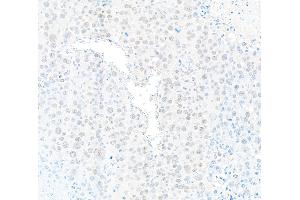Immunohistochemistry (IHC) image for anti-Protein Phosphatase 4, Catalytic Subunit (PPP4C) (AA 1-50) antibody (ABIN7454679)