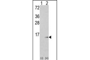 Western blot analysis of S100A6 (arrow) using rabbit polyclonal S100A6 Antibody (C-term) (ABIN391522 and ABIN2841482). (S100A6 antibody  (C-Term))