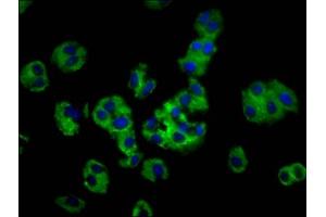 Immunofluorescence staining of HepG2 cells with ABIN7142134 at 1:100, counter-stained with DAPI. (MOGAT1 antibody  (AA 163-246))