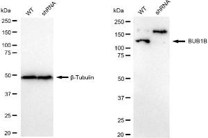 Western blotting analysis using BUB1B kinase antibody (ABIN7797804).