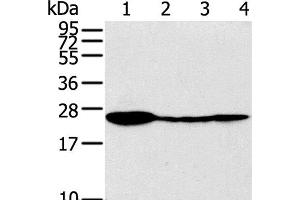 Western Blot analysis of Raji, 231, 293T and A549 cell using TPD52 Polyclonal Antibody at dilution of 1:320 (TPD52 antibody)