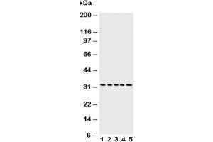 Western blot testing of Caspase-6 antibody and Lane 1:  MCF-7;  2: HeLa;  3: Jurkat;  4: CEM;  5: SW620 cell lysate
