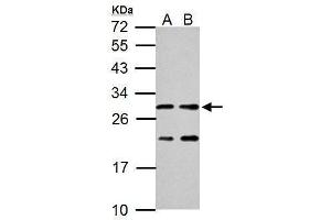WB Image Sample (30 ug of whole cell lysate)   A: Neuro 2A B: GL261 12% SDS PAGE  antibody diluted at 1:1000 (HSD17B10 antibody  (C-Term))