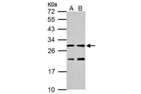 HSD17B10 Antikörper  (C-Term)