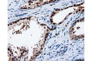 Immunohistochemistry (IHC) image for anti-Amyloid beta (A4) Precursor Protein (APP) antibody (ABIN1496880) (APP antibody)