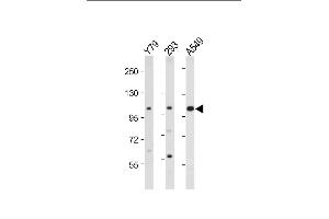 All lanes : Anti-hNEK4- at 1:2000 dilution Lane 1: Y79 whole cell lysate Lane 2: 293 whole cell lysate Lane 3: A549 whole cell lysate Lysates/proteins at 20 μg per lane. (NEK4 antibody  (C-Term))