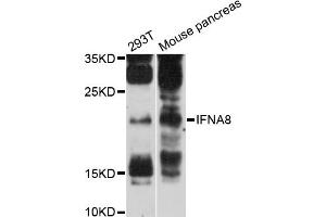 Western blot analysis of extracts of various cell lines, using IFNA8 antibody (ABIN6293097) at 1:3000 dilution.