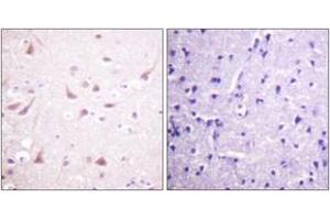 Immunohistochemistry analysis of paraffin-embedded human brain tissue, using DRP-2 (Ab-514) Antibody. (DRP2 antibody  (AA 480-529))