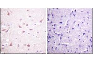 Immunohistochemistry analysis of paraffin-embedded human brain tissue, using DRP-2 (Ab-514) Antibody. (DRP2 antibody  (AA 480-529))
