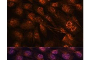Immunofluorescence analysis of C6 cells using MAP2K7 Polyclonal Antibody at dilution of 1:100. (MAP2K7 antibody)