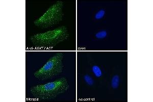 ABIN570702 Immunofluorescence analysis of paraformaldehyde fixed HeLa cells, permeabilized with 0. (AGXT antibody  (Internal Region))
