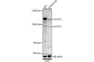 Western blot analysis of extracts from wild type(WT) and ST knockdown (KD) 293T cells, using ST antibody (ABIN1678782, ABIN3017845, ABIN3017846 and ABIN7101526) at 1:1000 dilution. (STAT2 antibody)