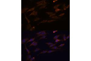 Immunofluorescence analysis of C6 cells using RPL7A antibody (ABIN6128658, ABIN6147151, ABIN6147153 and ABIN6218286) at dilution of 1:100. (RPL7A antibody  (AA 1-266))