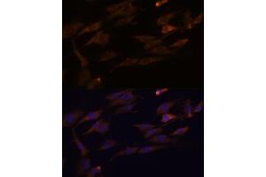 Immunofluorescence analysis of C6 cells using RPL7A antibody (ABIN6128658, ABIN6147151, ABIN6147153 and ABIN6218286) at dilution of 1:100. (RPL7A antibody  (AA 1-266))