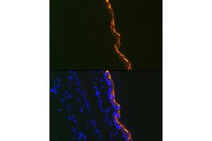 Immunofluorescence analysis of Mouse tail and ear using Cytokeratin 10 Rabbit mAb (ABIN1679404, ABIN3019133, ABIN3019134 and ABIN7101721) at dilution of 1:100 (40x lens). (Keratin 10 antibody)