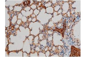 ABIN6267395 at 1/200 staining Mouse lung tissue sections by IHC-P. (GATA1 antibody  (pSer142))