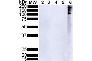Western Blotting (WB) image for anti-Synuclein, alpha (SNCA) (AA 124-134), (pSer129) antibody (FITC) (ABIN6932878)