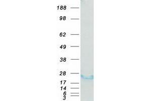 Validation with Western Blot (GTPase NRas Protein (NRAS) (Myc-DYKDDDDK Tag))