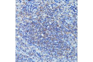 Immunohistochemistry of paraffin-embedded mouse spleen using CSF3 antibody (ABIN6127710, ABIN6139100, ABIN6139101 and ABIN6221772) at dilution of 1:100 (40x lens). (G-CSF antibody  (AA 30-207))