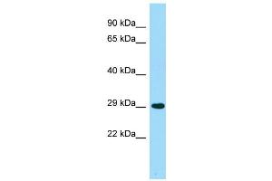 WB Suggested Anti-ACER2 Antibody Titration: 1. (ACER2 antibody  (Middle Region))